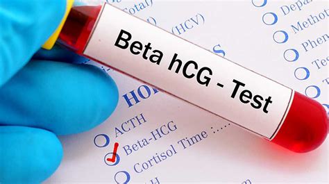 Beta HCG Değeri: Gebelikte Beta HCG Değerinin Anlamı